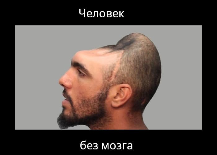 Человек без мозга
