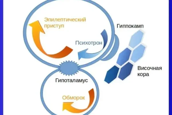 Отличие обморока от эпилептического приступа - концепция Андрея Булатова